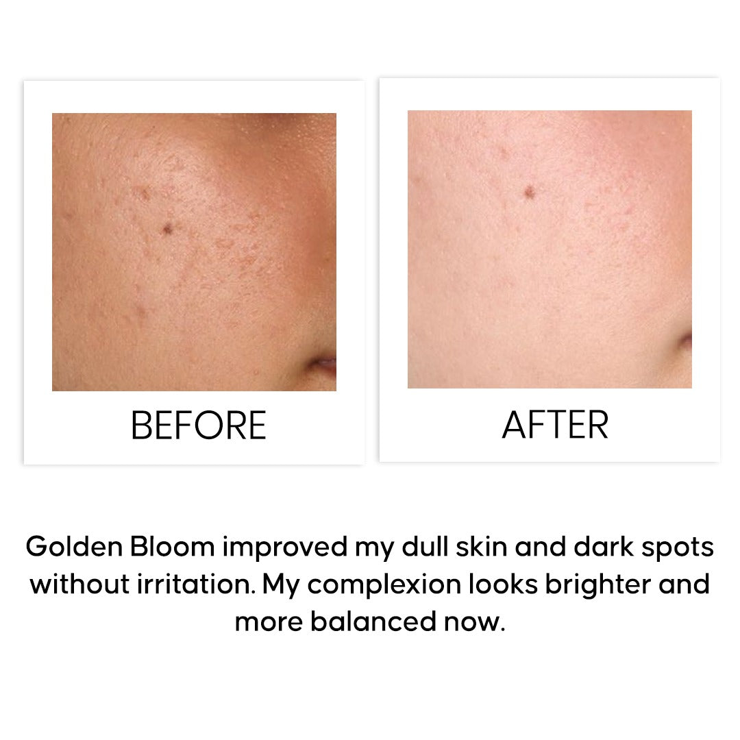 Golden Bloom Brightening Vitamin C Serum 30 ml