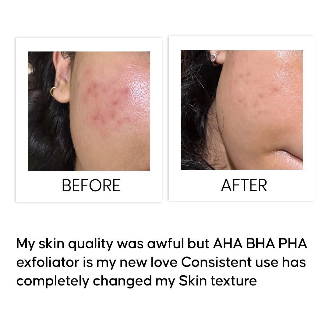 AHA BHA PHA Maximum Renewal Exfoliator 15 ml