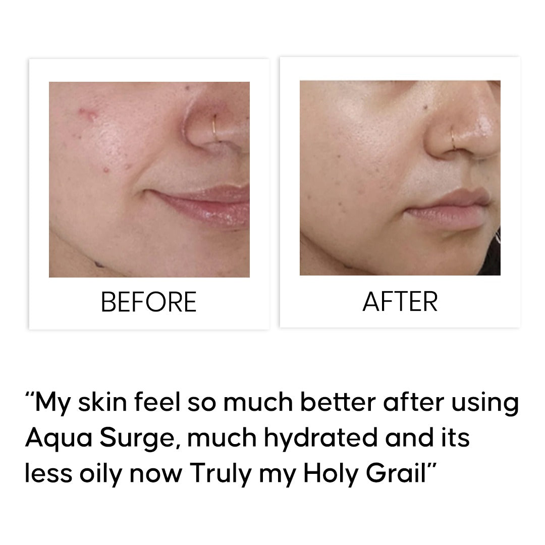 Aqua Surge Ultra Hydrating Niacinamide Serum 30 ml