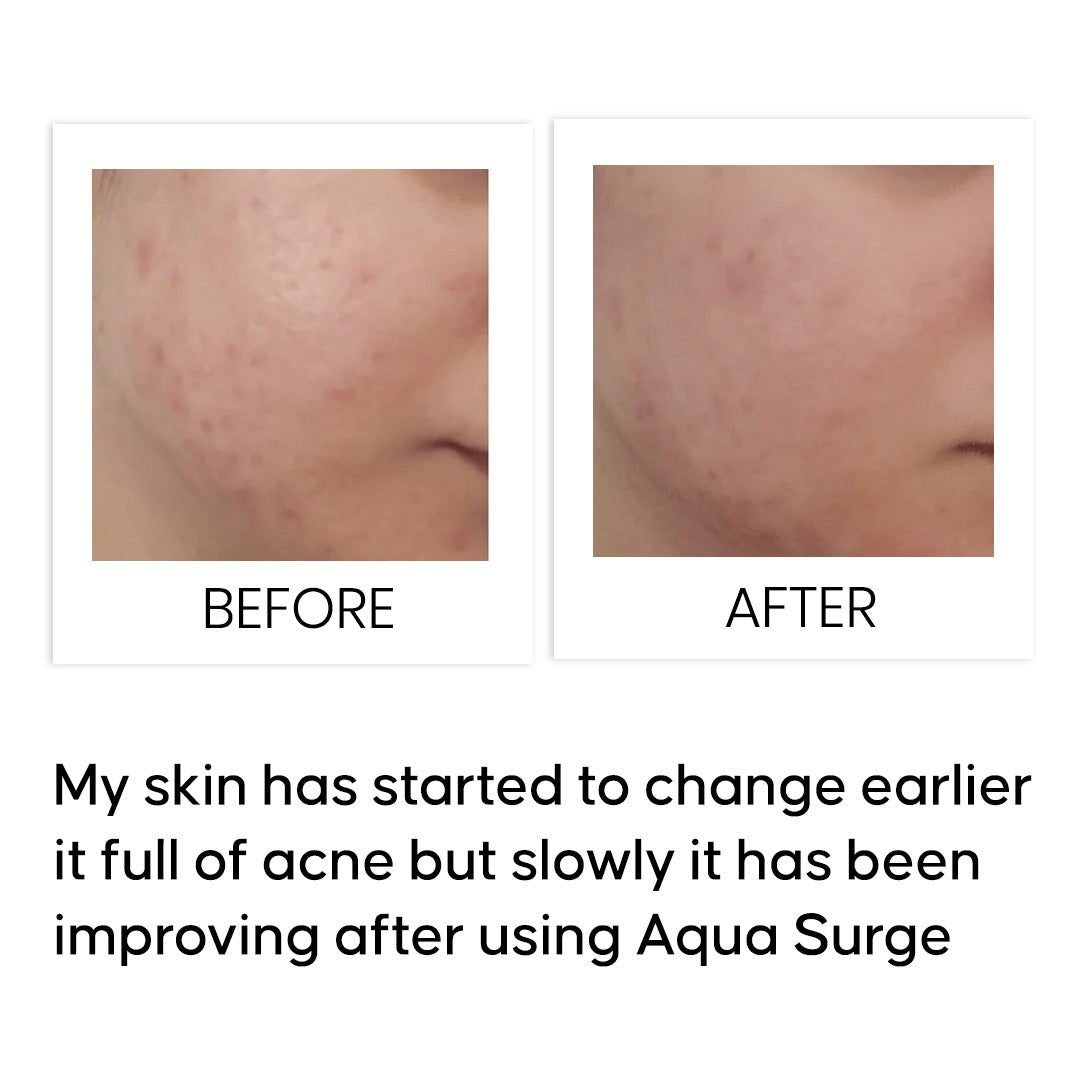 Aqua Surge Ultra Hydrating Niacinamide Serum 10 ml