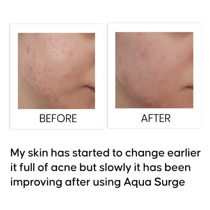 Aqua Surge Ultra Hydrating Niacinamide Serum 10 ml
