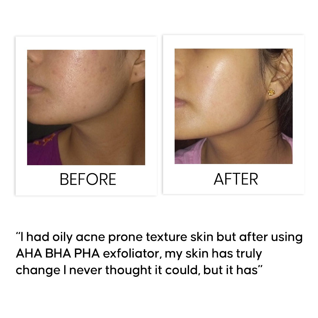 AHA BHA PHA Maximum Renewal Exfoliator 50 ml