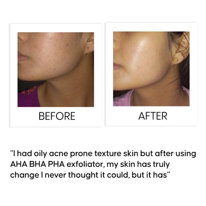 AHA BHA PHA Maximum Renewal Exfoliator 50 ml